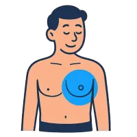 rind — illustration of chest